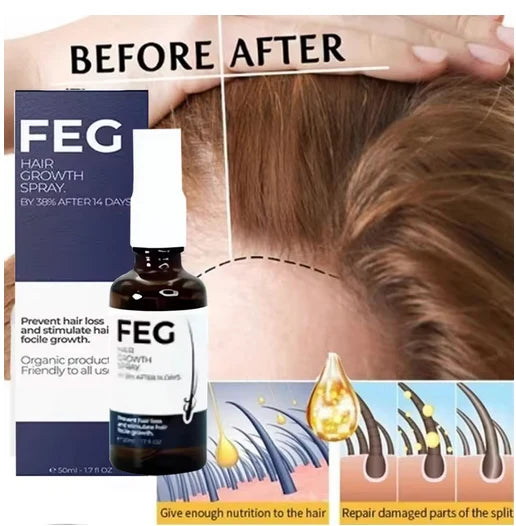 FEG Plus Hair Growth Spray – Nourishing Hair Regrowth & Hair Strengthening Spray for Men & Women